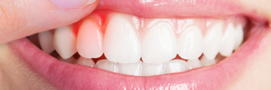 又上火又怕冷？上熱下寒、水火不濟，教你調(diào)回來！