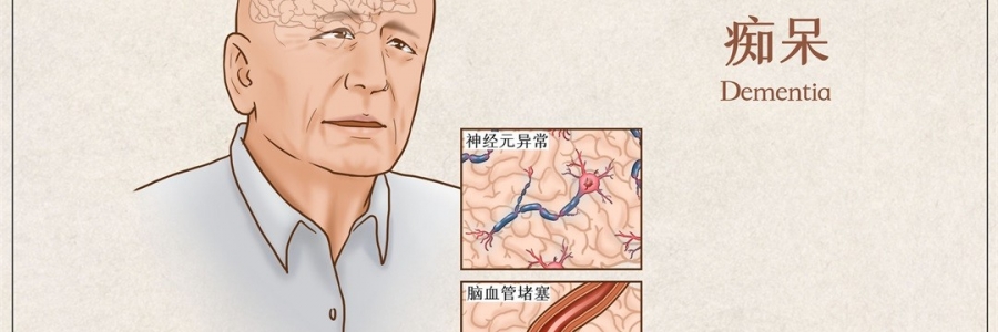 “馬什么梅？”年紀輕輕老忘事，竟是癡呆的前兆？！