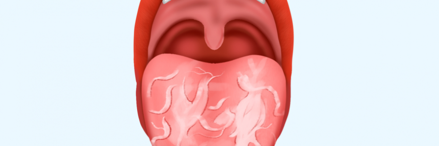 舌苔辨識“九種中醫體質”（配圖）