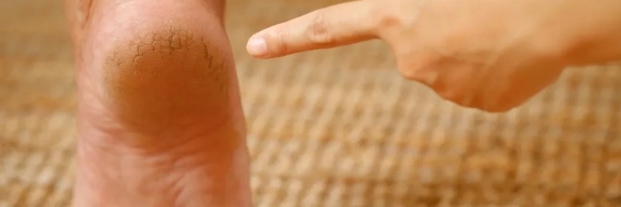 每天跺跺腳，從腳養到頭，越跺越年輕！